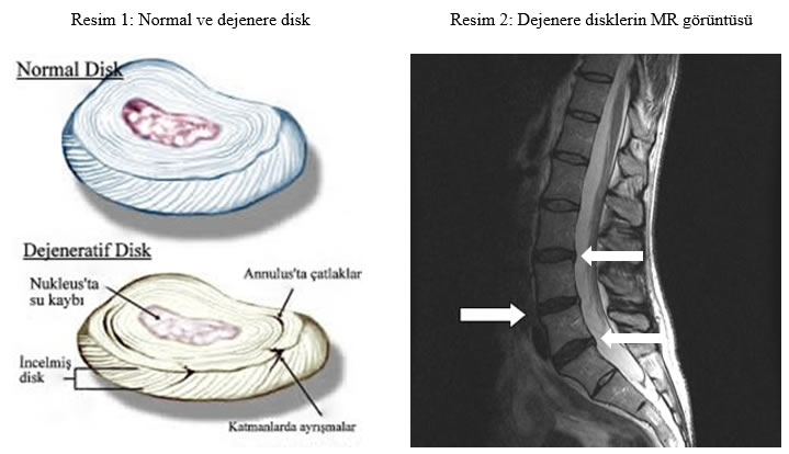 8normalvedejeneredisk